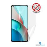 Screenshield Anti-Bacteria XIAOMI Mi 11 Lite 5G folie na displej XIA-MI11LT5GAB-D