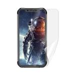 Screenshield fólie na displej pro IGET Blackview GBV9600 Pro IGT-GBV9600PR-D