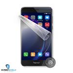 Screenshield™ Huawei Honor 8 HUA-HON8-D