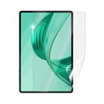 Screenshield HUAWEI Honor Pad X8a fólie na displej HUA-HONPX8A-D