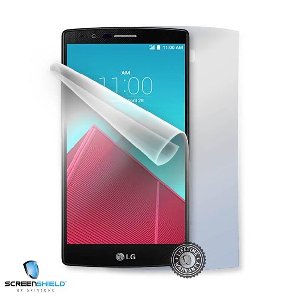 ScreenShield LG H635 G4 Stylus - Film for display + body protection LG-H635-B