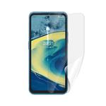 Screenshield NOKIA XR20 5G fólie na displej NOK-XR205G-D