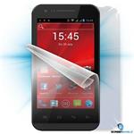 ScreenShield ochranná fólia na displej a kryt pre PRESTIGIO Multiphone PAP4044DUO, priehľadná PRE-PAP4044D-B
