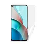 Screenshield XIAOMI Mi 11 Lite 5G folie na displej XIA-MI11LT5G-D