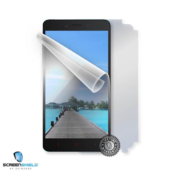 ScreenShield Xiaomi Redmi Note 2 - Film for display + body protection XIA-RENO2-B