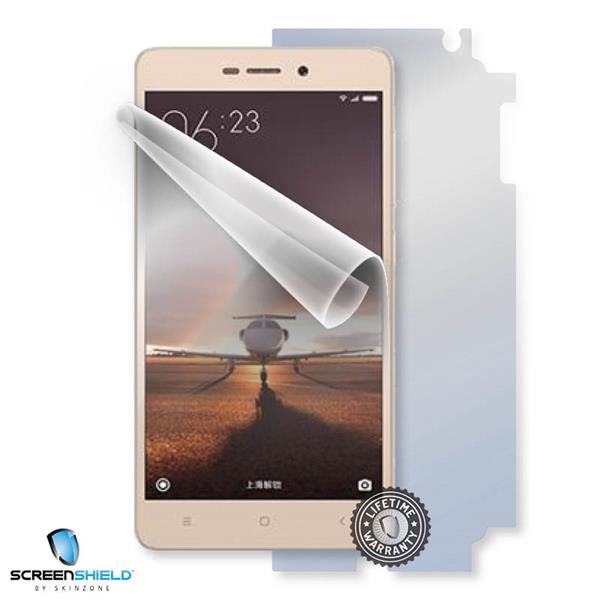 ScreenShield Xiaomi Redmi Redmi 3 - Film for display + body protection XIA-REDMI3-B